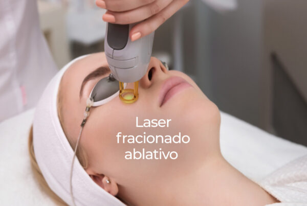 BRU_TRAT_LASER_ABLATIVO